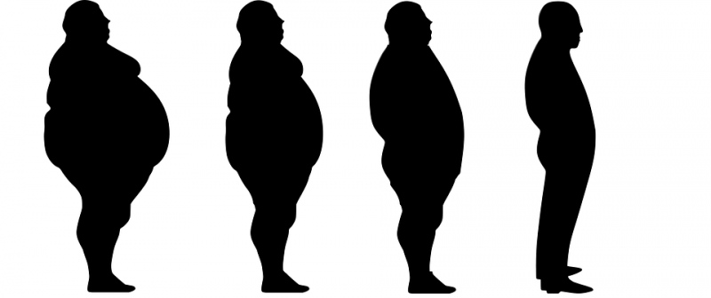 单纯性肥胖怎样治疗为什么会单纯性肥胖